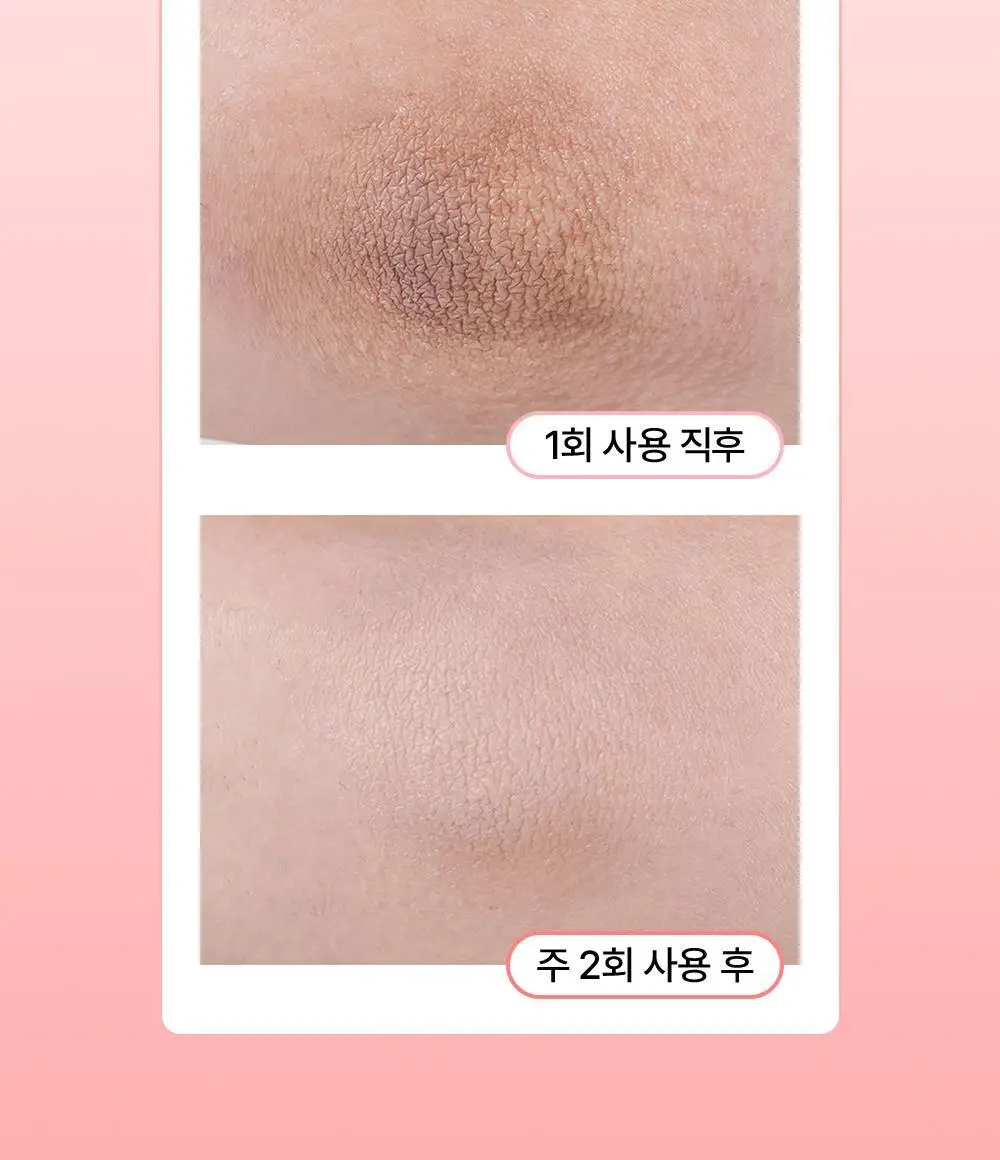 [꿈치케어/미백] 낫포유 브라이트닝 SOS 바디패드 10매입 상세페이지 16